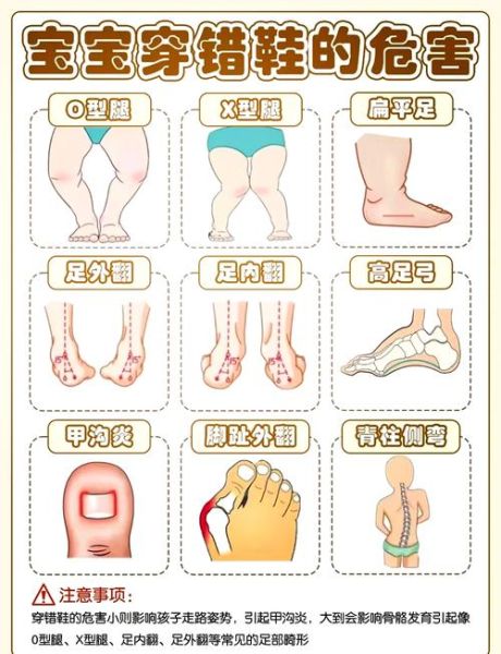 五个月宝宝脚尖着地正常吗_如何纠正