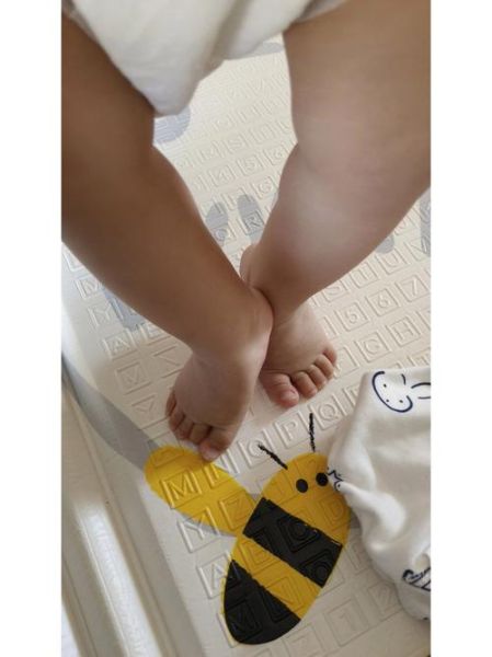 五个月宝宝脚尖着地正常吗_如何纠正