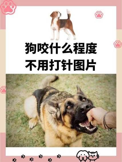 梦到狗咬手是什么意思_被狗咬手预示什么