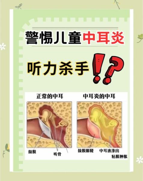 宝宝中耳炎怎么治疗_家庭护理要点