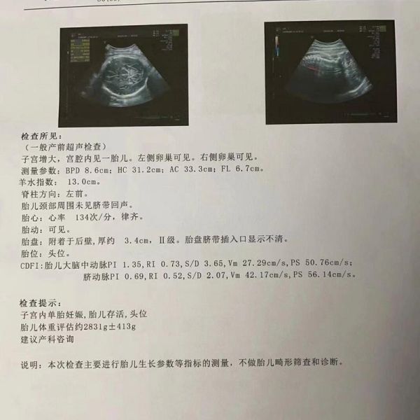 宝宝腹围偏大是什么原因_需要做什么检查