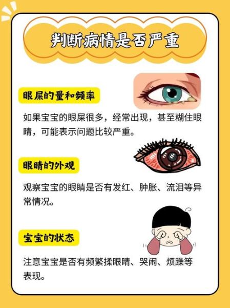 宝宝眼睛有黄色眼屎怎么办_新生儿眼屎多正常吗