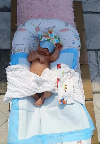 宝宝晒黄疸晒哪个部位_新生儿黄疸晒太阳正确方法