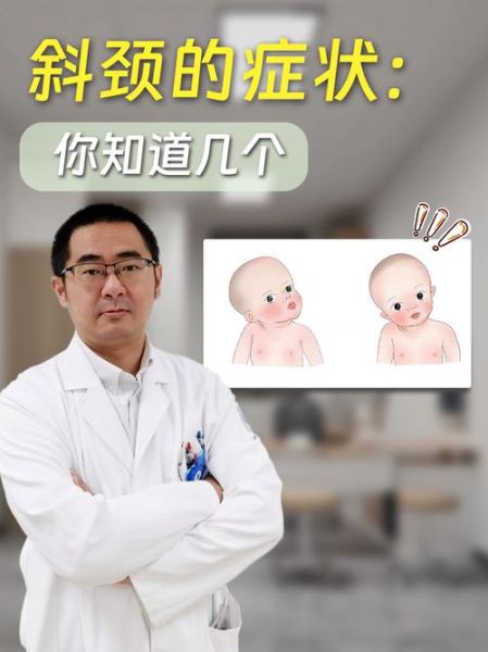 宝宝斜颈症状有哪些_婴儿斜颈怎么判断