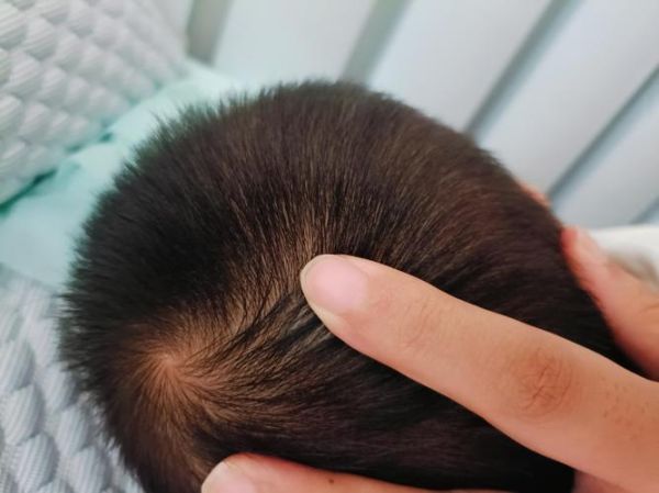 宝宝头上突然鼓起硬包怎么办_宝宝头上硬包多久能消