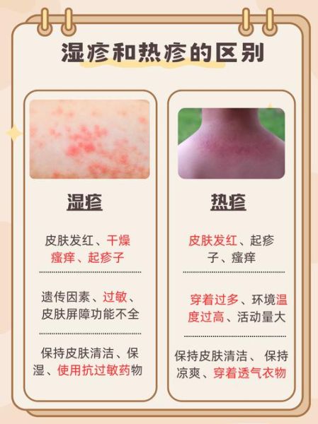 宝宝热疹子图片_热疹和湿疹区别