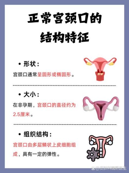 宫颈图片大全_正常与异常如何区分