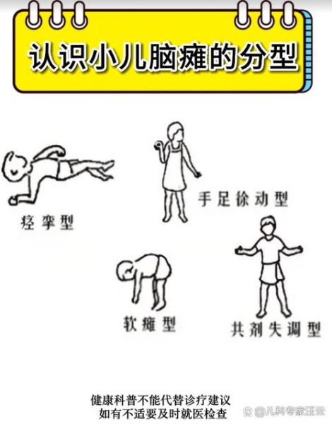 宝宝肌张力低是脑瘫吗_肌张力低与脑瘫区别