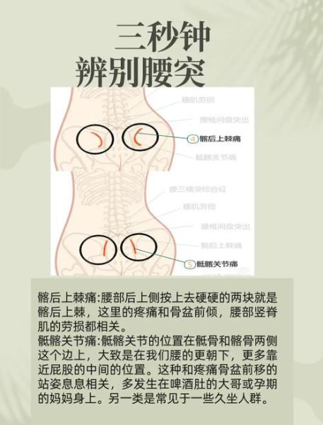 腰疼的位置图片大全_不同部位腰痛代表什么病