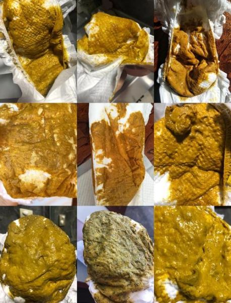 四个月宝宝便血怎么回事_需要立即就医吗