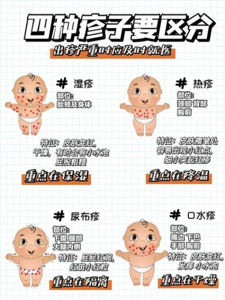 宝宝湿疹过敏源有哪些_如何快速排查