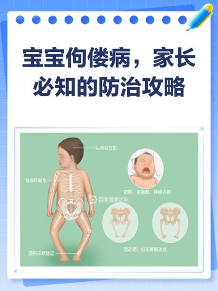 宝宝佝偻病的早期症状图片_如何辨别佝偻病初期表现