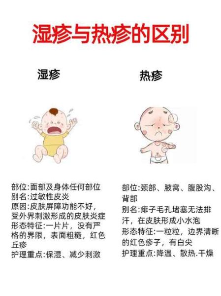 宝宝湿疹反复怎么办_肤专家真的有用吗