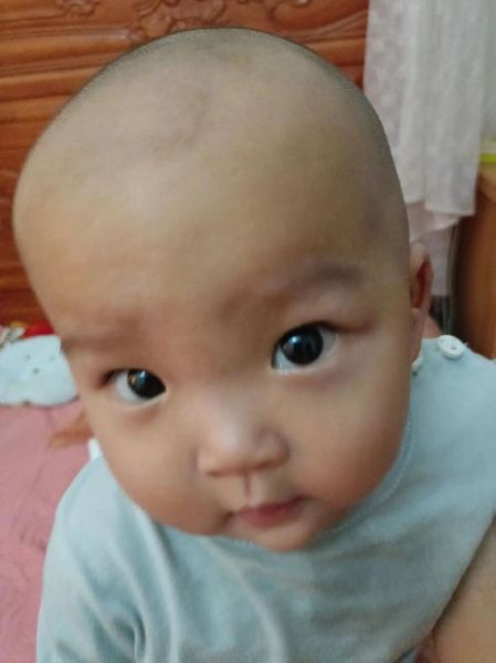 宝宝可以剃眉毛吗_剃眉毛会不会影响毛囊